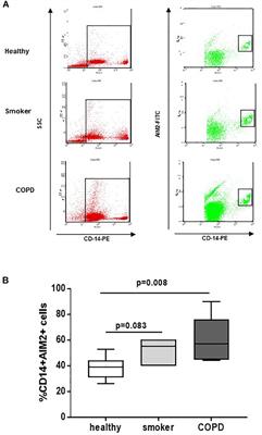 AIM2 Inflammasome Activation Leads to IL-1α and TGF-β Release From Exacerbated Chronic Obstructive Pulmonary Disease-Derived Peripheral Blood Mononuclear Cells